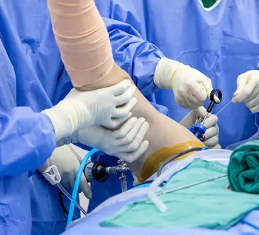 Shoulder Surgery